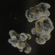 Cassisomes as seen through a microscope. The oval structures are laced with toxic capsules known as nematocysts, and the brown blobs are symbiotic algae that live within the tissues of Cassiopea.